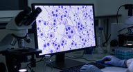 Acetate Attenuates Microglial Inflammation in Traumatic Brain Injury Model, Not Sepsis