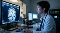 Anterior Temporal Atrophy Precedes Semantic Dementia Symptoms by Five Years
