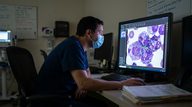 Itraconazole Inhibits OXPHOS in AML, Targets Therapy-Resistant Leukemic Stem Cells