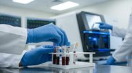 Multiomic Analysis Reveals CTCL Progression Mechanisms, Identifies Therapeutic Targets