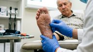 Plantar Agraphesthesia Signals Lower Limb Cortical Sensory Loss in Corticobasal Syndrome
