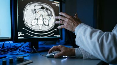 AI Detects Occult Pancreatic Cancer 15 Months Before Radiologists on CT