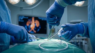 Automated Software Identifies Hundreds of Patients Lost to Aneurysm Follow-Up