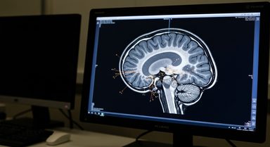 Baseline Connectivity Predicts Anxiety Improvement in Prefrontal TMS Trial