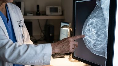 Benign Calcifications Drive False-Positive AI Risk Scores in Mammography