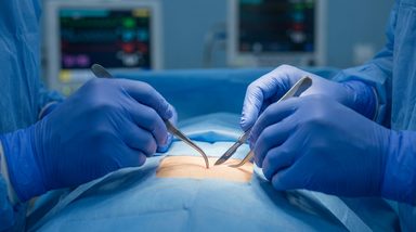 Combined Surgical Approach Improves Severe VLS Stenosis, Reduces Corticosteroid Need