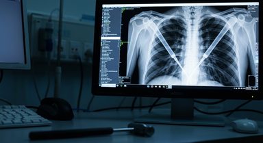 Daily Resistance Training and Verticalization Safe During ECMO Support