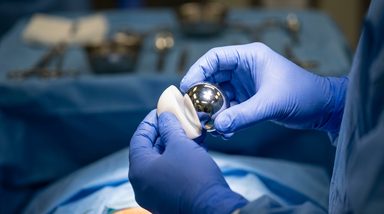 Direct Anterior Approach Reduces Dislocation Risk in Head and Liner Exchange