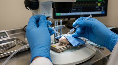 EPAC2 Antagonism Restores Cortical Function, Behavior in Fragile X Mouse Model