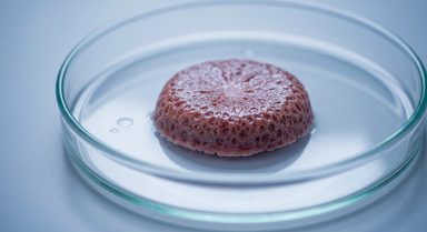 Everolimus Reduces Cancer Risk and Proves Cost-Effective in Liver Transplant