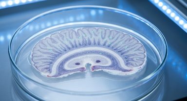 GABAA Gain-of-Function Mutation Triggers Seizures via Interneuron Network Collapse in Mice