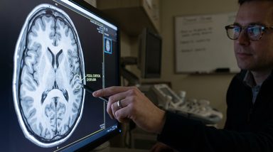 Homozygous LGI1 Variant Linked to Severe Developmental and Epileptic Encephalopathy