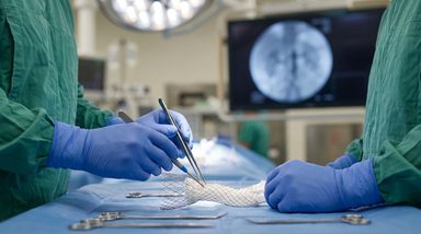 Physician-Modified Grafts Show Higher Renal Stability Than TAMBE Devices
