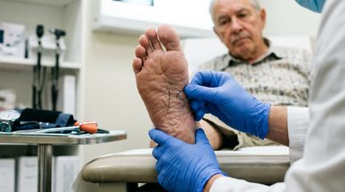 Plantar Agraphesthesia Signals Lower Limb Cortical Sensory Loss in Corticobasal Syndrome