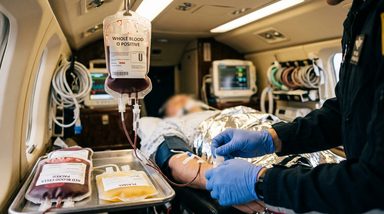 CBD's Pain Modulation Effects Vary by Opioid Dosing Timing in OUD Patients