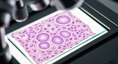 Quantiferon-CMV Guided Prophylaxis Fails to Lower Infection in Seropositive Kidney Recipients